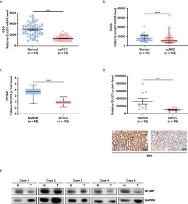 GLUD1 suppresses renal tumorigenesis and development via inhibiting PI3K/Akt/mTOR pathway